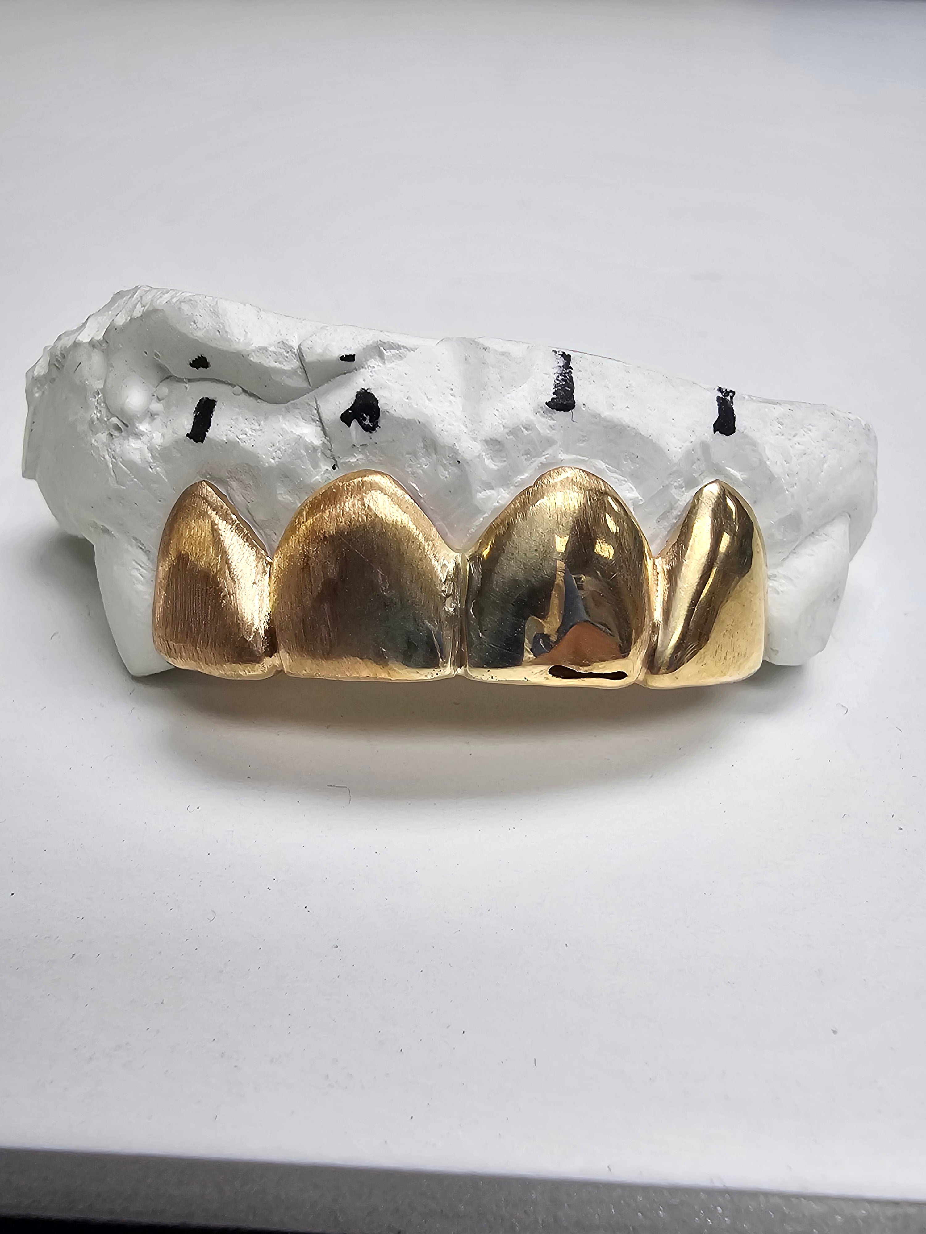 Single Tooth Gold