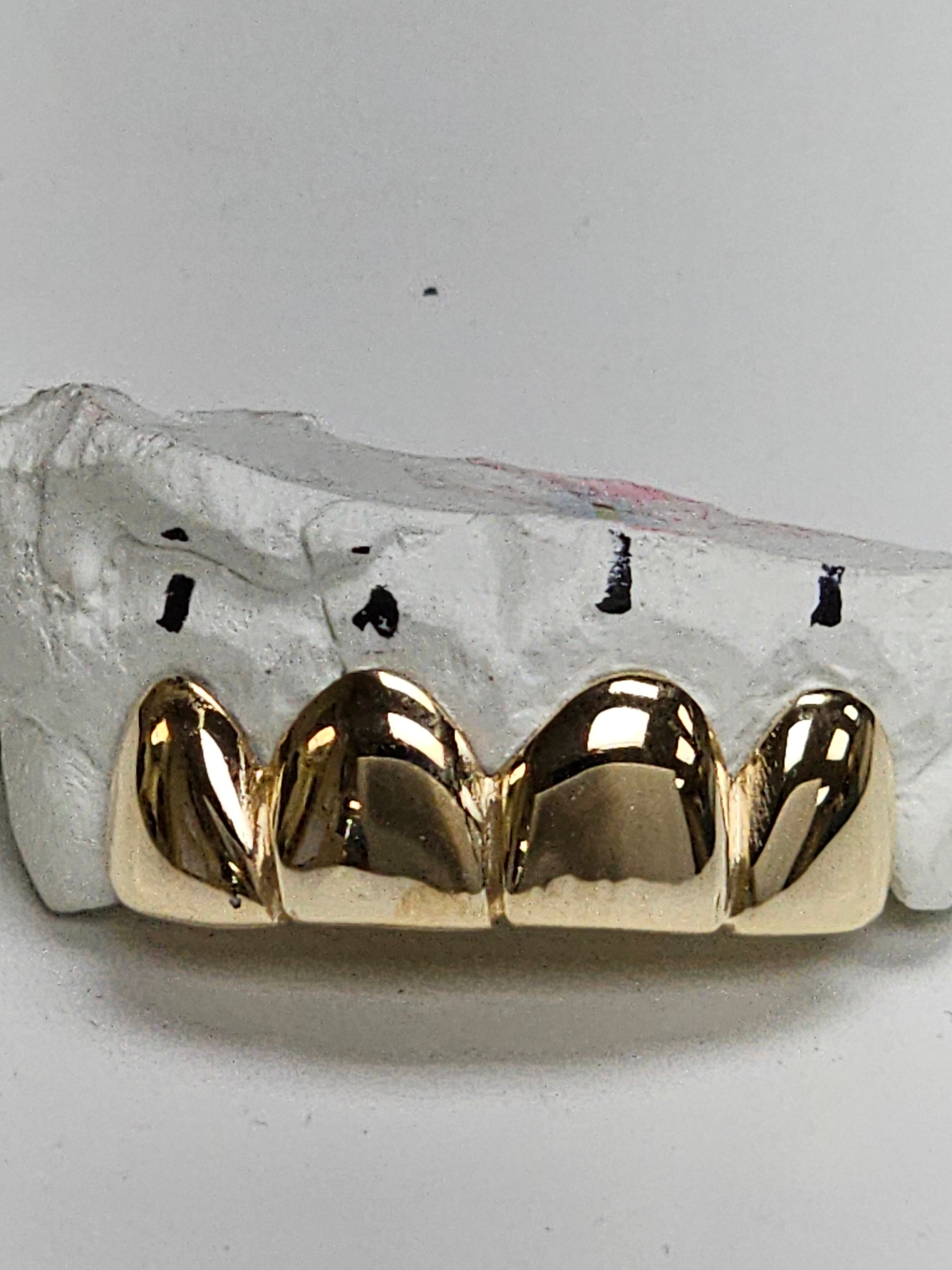 Single Tooth Gold
