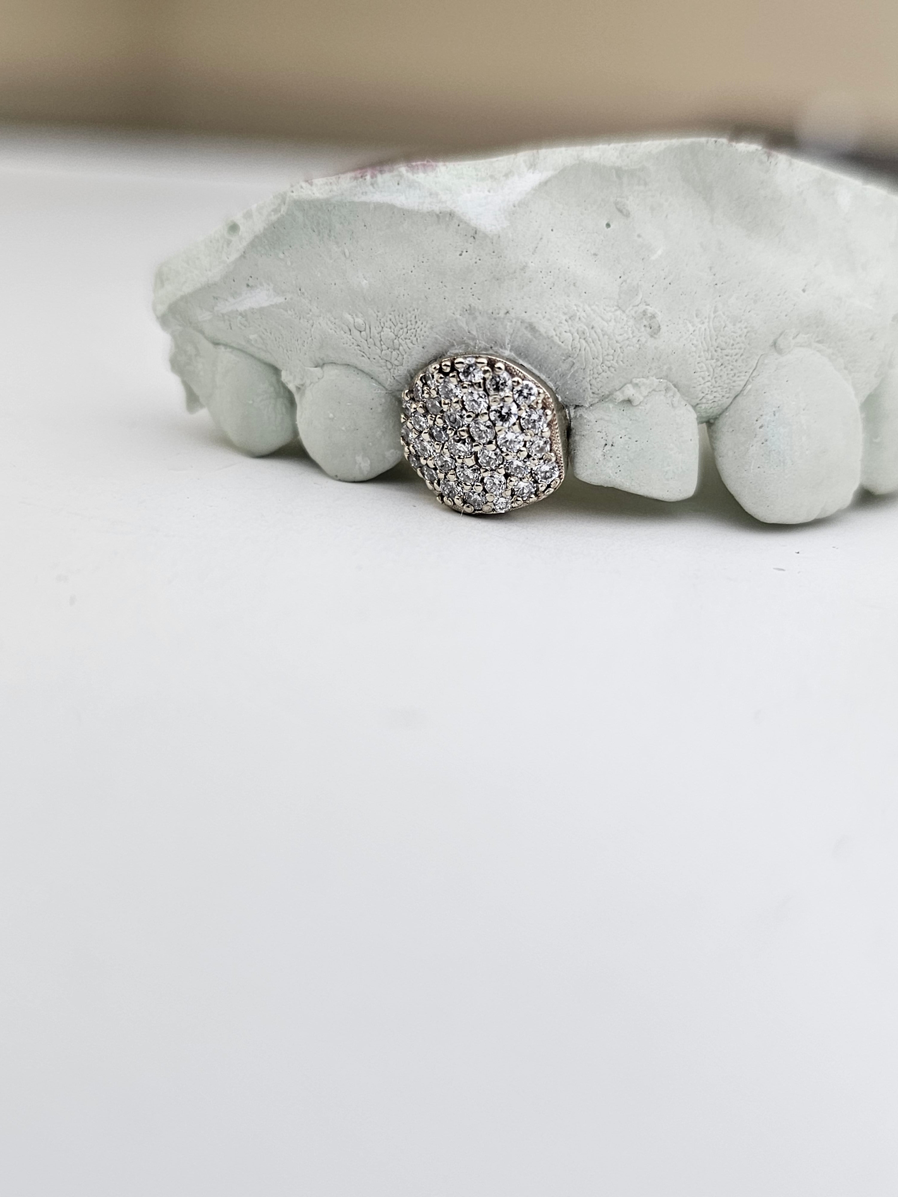 Single Tooth Lab Grown Diamond